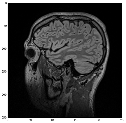Sagittal cross-section of the original MRI dataset clearly showing the white and gray matter of the brain among other tissues.