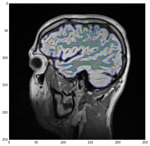 Label overlay showing both white and gray matter as edge-only contours.