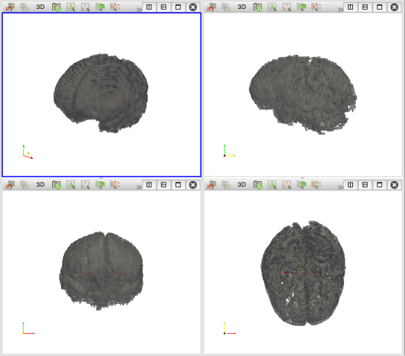 Isosurface of the multi-modal segmentation performed on each of the T1 and T2 images.